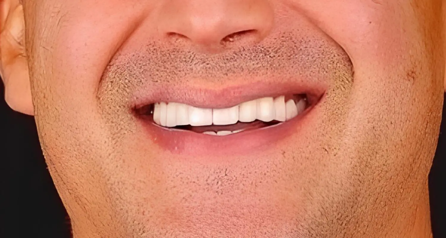 A6 (3)